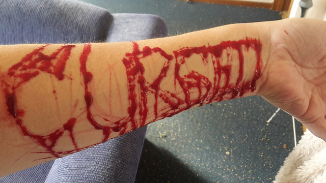 Cursed carved into my arm)